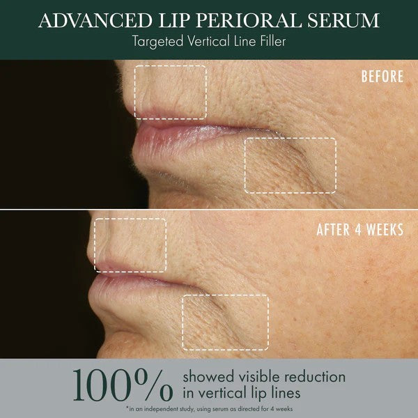 REVIVE - RéVive Lip & Perioral Renewal Serum
